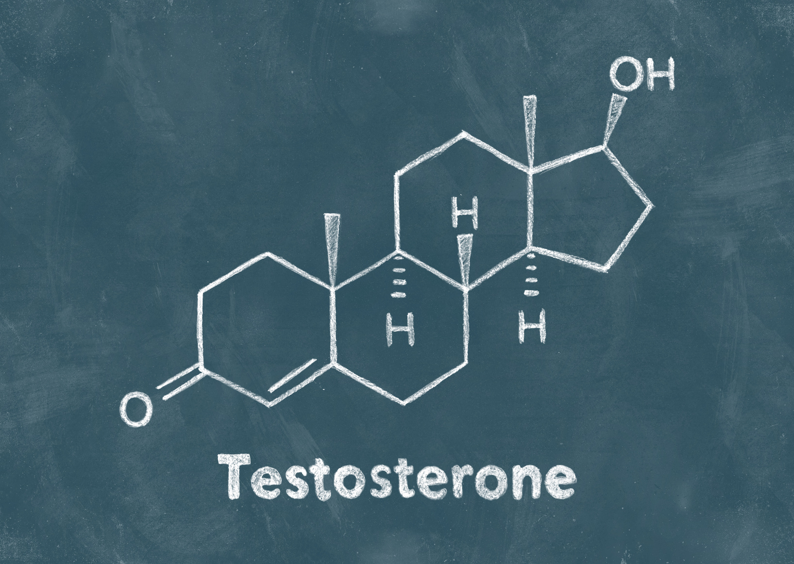 Тестостеронов дефицит
